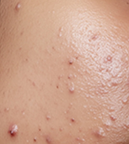 LBMLBM™ Overnight Dark Spot Serum image LBMLBM™ Overnight Dark Spot Serum