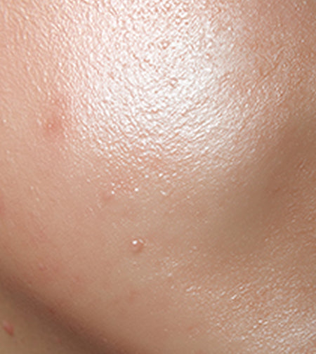 LBMLBM™ Overnight Dark Spot Serum image LBMLBM™ Overnight Dark Spot Serum