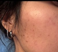 LBMLBM™ Overnight Dark Spot Serum image LBMLBM™ Overnight Dark Spot Serum