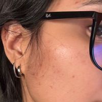 LBMLBM™ Overnight Dark Spot Serum image LBMLBM™ Overnight Dark Spot Serum